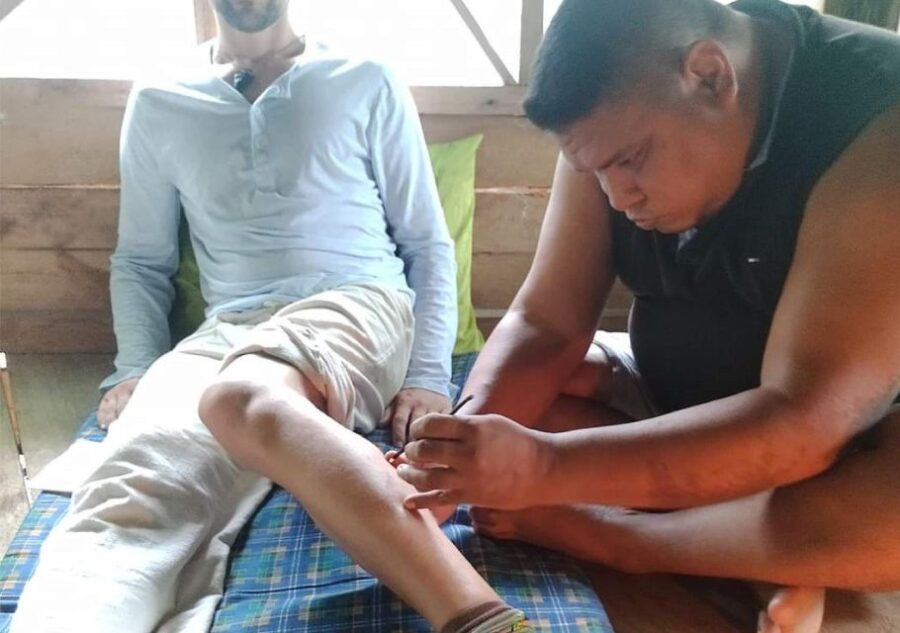 Iquitos: Medicinal Treatment With Kambo