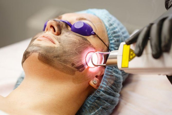 Spectral Peeling Laser Black Doll in Bemerode - Overview of Spectral Peeling Laser